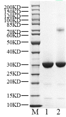 HRI(delta V237-Y376, D442N) Protein, Human