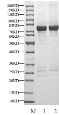 CHK1 GST Tag Protein, Human