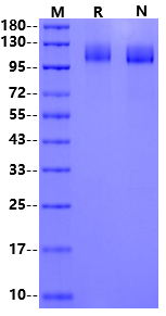 VEGF R2/Flk-1/KDR His Tag Protein, Rhesus macaque
