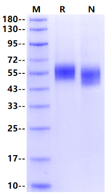 IL-1 RII/CD121b His Tag Protein, Human