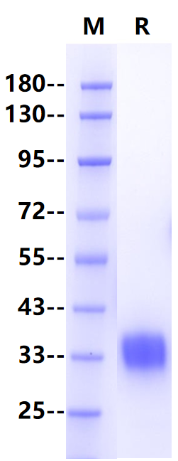 Adiponectin His Tag Protein, Human