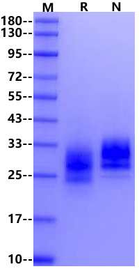 TFPI-2 His Tag Protein, Human