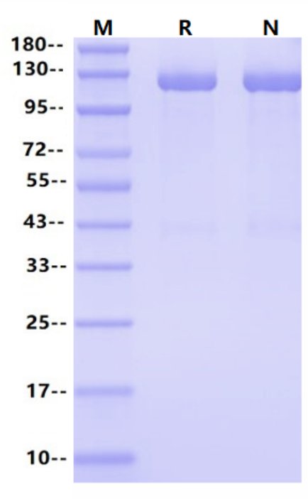 USP7 Flag&His Tag Protein, Human