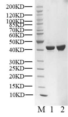 CSNK2A1 His Tag Protein, Human