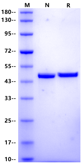 Cardiac Troponins T (cTnT) His Tag Protein, Human
