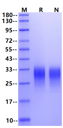 CD300f/LMIR3/IREM-1 His Tag Protein, Human