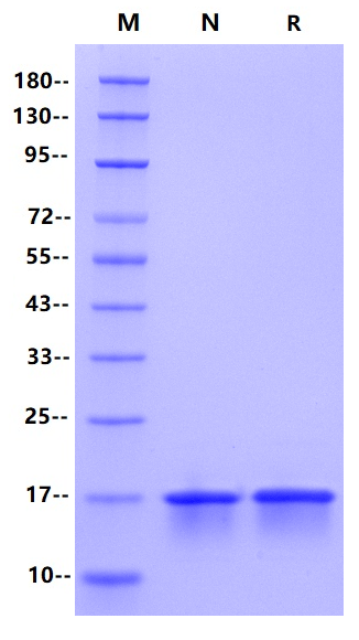 Nucleocapsid CTD His Tag Protein, SARS-CoV-2