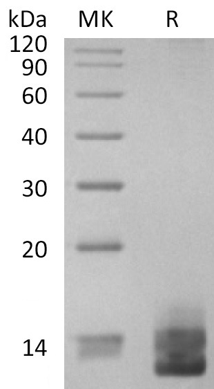 ITPRIPL1 His Tag Protein, Human