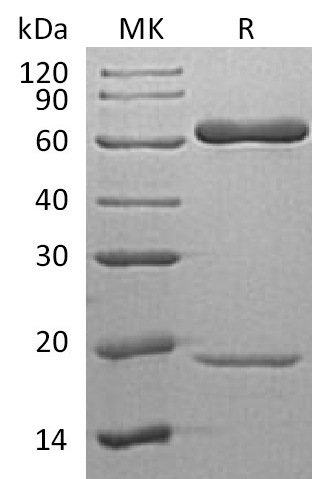 PCSK9 His Tag Protein, Human
