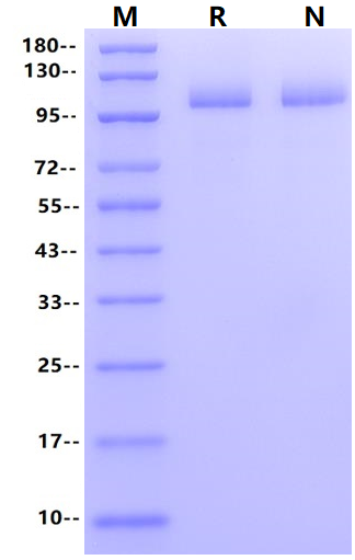 USP4 Flag&His Tag Protein, Human