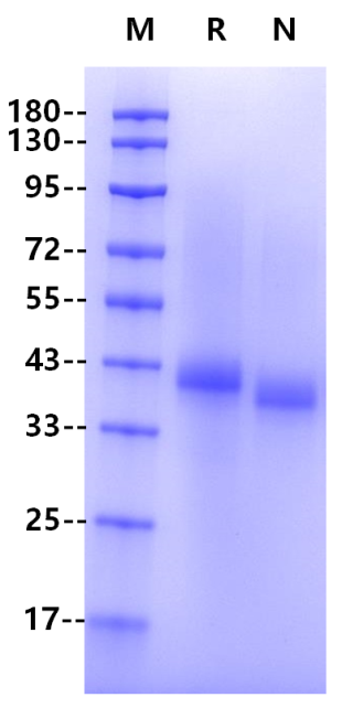 Fc epsilon RII/CD23 His Tag Protein, Human