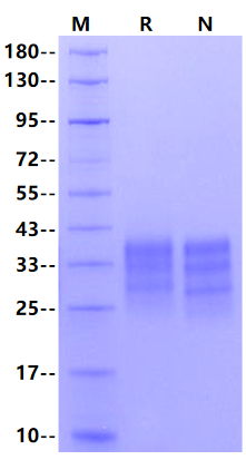Fas/TNFRSF6/CD95 His Tag Protein, Human