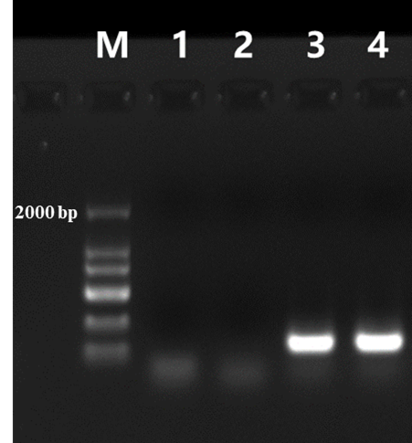M-MLV Reverse Transcriptase