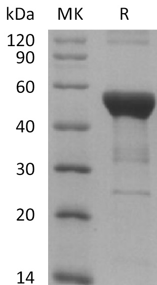 NFKB1 Protein,Human