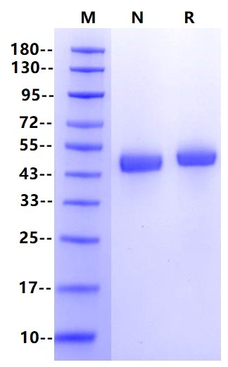ACPP His Tag Protein, Human