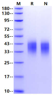 CD300c/LMIR2 His Tag Protein, Human