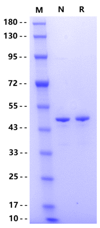 SerpinB3/SCCA Protein, Human