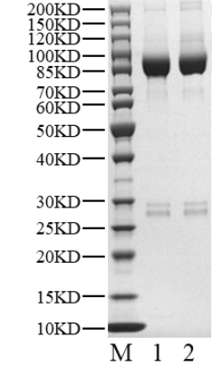 GRK5 His&GST Tag Protein, Human