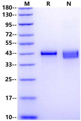 DUSP6 His Tag Protein, Human