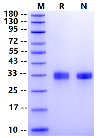 Biotinylated Angiopoietin-2/ANGPT2 (275-496) Avi&His Tag Protein, Human