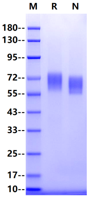 Axl His Tag Protein, Mouse