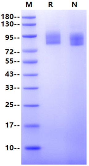 MUC18/CD146 His Tag Protein, Human