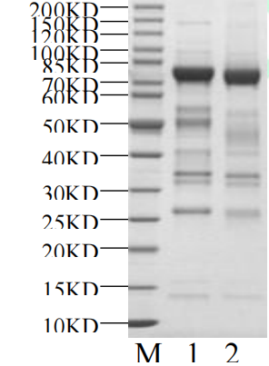 SRPK1 Protein, Human
