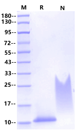 CCL14a/HCC-1(72aa) Protein, Human