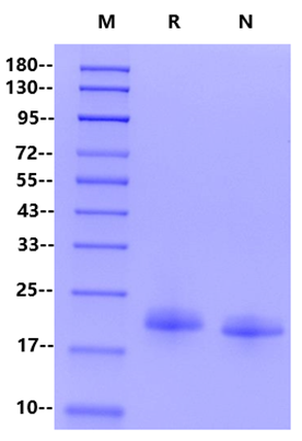 Ephrin-A4 His Tag Protein, Human