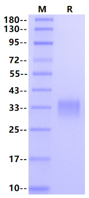 CD8 alpha His Tag Protein, Mouse