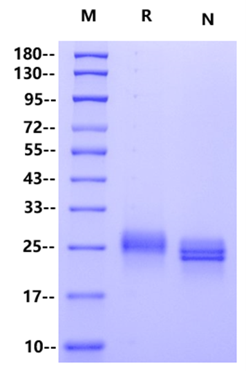 Ephrin-A1 His Tag Protein, Human