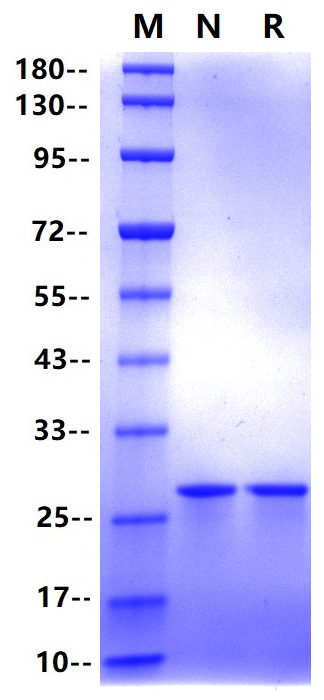 Apolipoprotein A-I/APOA1 His Tag Protein, Human