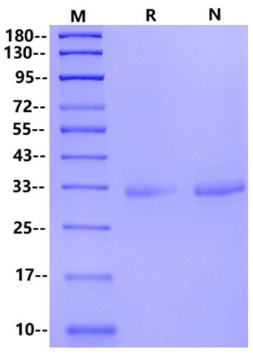 MSLN/Mesothelin (37-286) His Tag Protein, Human