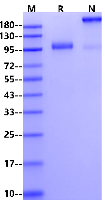 IL-12 R beta 1 Fc Chimera Protein, Human