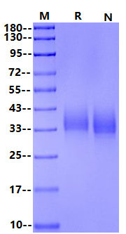 NTB-A/SLAMF6 His Tag Protein, Human