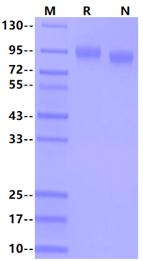 Endoglin/CD105 His Tag Protein, Human