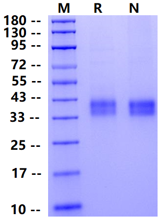 Biotinylated ASGR1/ASGPR1 His&Avi Tag Protein, Human