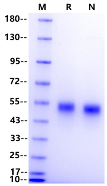Ephrin-B1 His Tag Protein, Human