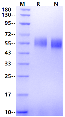 MICA His Tag Protein, Human