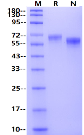 ROR1 His Tag Protein, Human