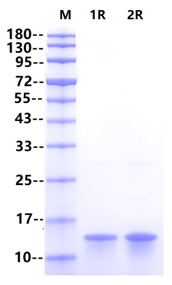 Apo-SAA2 His Tag Protein, Human