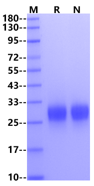 ROR1 (39-151, Ig-like Domain) His Tag Protein, Human/Cynomolgus