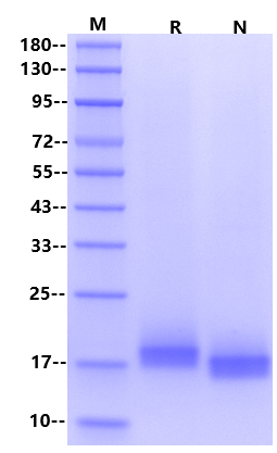 ROR1 (308-395, Kringle Domain) His Tag protein, Human 