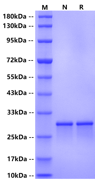 Cardiac Troponins I (cTnI) His Tag Protein, Human