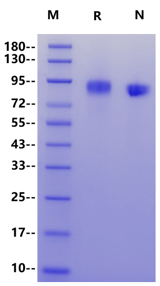 Her3 His Tag Protein, Human