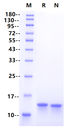 β2-Microglobulin/B2M His Tag Protein, Human