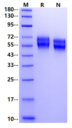IL-18Rα/IL-1R5 His Tag Protein, Human