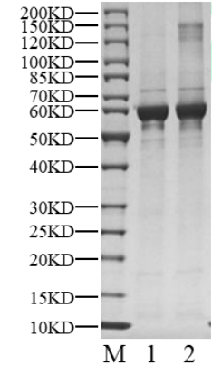 CAMKK1 His Tag Protein, Human