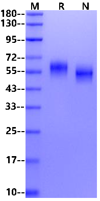 IL-1RAcP/IL-1R3 His Tag Protein, Cynomolgus/Rhesus macaque