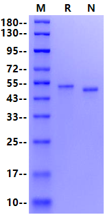 Carbonic Anhydrase IX/CA9 His Tag Protein, Cynomolgus